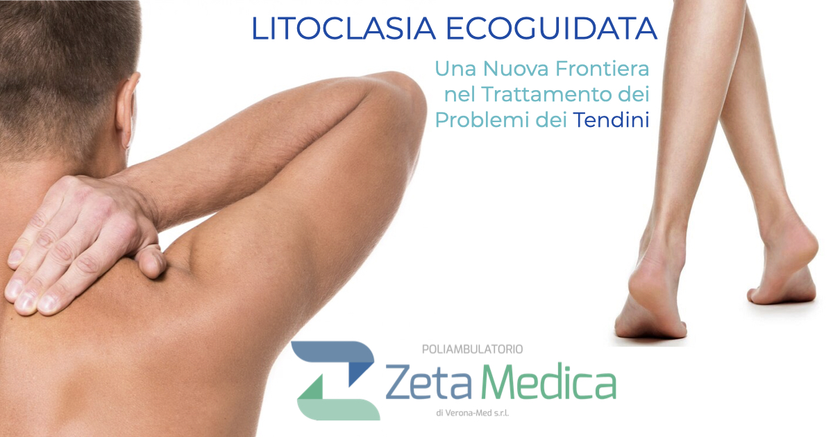litoclasia tendinopatie spalla gomito ginocchio e tendine di achjille dott. aliberti zetamedica verona